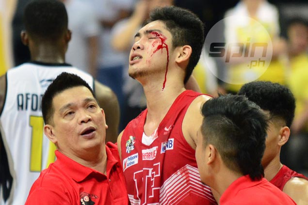 Will Bartolome shrugs off bloody cut, says hit from UST import Afoakwah 'unintentional'