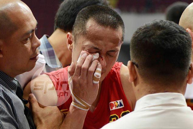 Chico Lanete gruesome eye injury the only dampener to shock Barako win over Ginebra