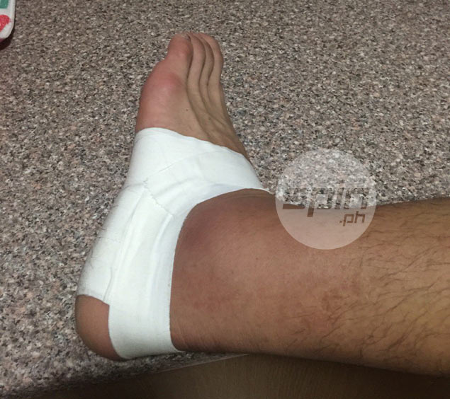 Gary David shows injured ankle, pleads for understanding from fans amid