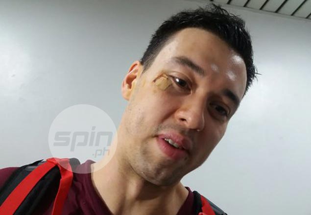 Greg Slaughter gets stiches in hospital after accidental elbow from teammate Aguilar