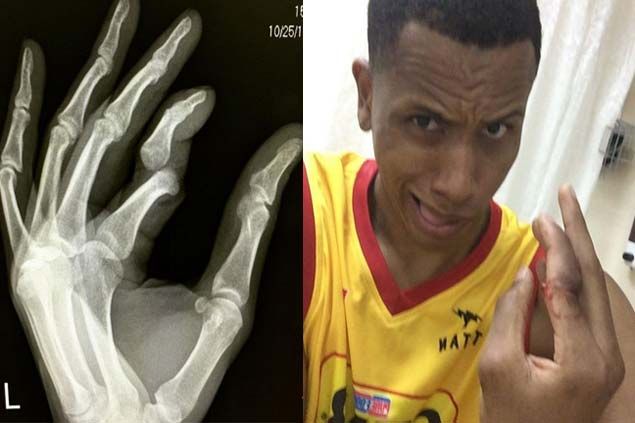 Star center Rafi Reavis out for remainder of PH Cup elims due to dislocated finger